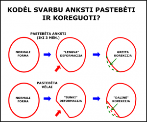 nuguleta kudikio galvyte; plagiocefalija; kreiva galvyte; plokscias pakausis