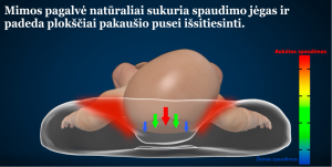 plagiocefalija nuguleta galvyte; kreiva galvyte; pagalve kudikiui; ortopedine pagalve kudikiui